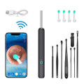 Máy lấy ráy tai có hình ảnh HD sắc nét thông minh thế hệ mới 