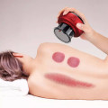 Máy giác hơi mini cầm tay không dùng lửa giảm đau nhức 