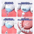 Máy tăm nước không dây kèm 4 đầu phun phù hợp cho người niềng răng, Màu trắng