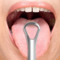 Dụng cụ vệ sinh lưỡi loại bỏ hôi miệng bằng thép không gỉ