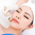 Cây lăn kim da mặt tiện dụng, cải thiện làn da