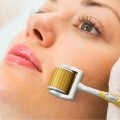 Cây lăn kim da mặt tiện dụng, cải thiện làn da